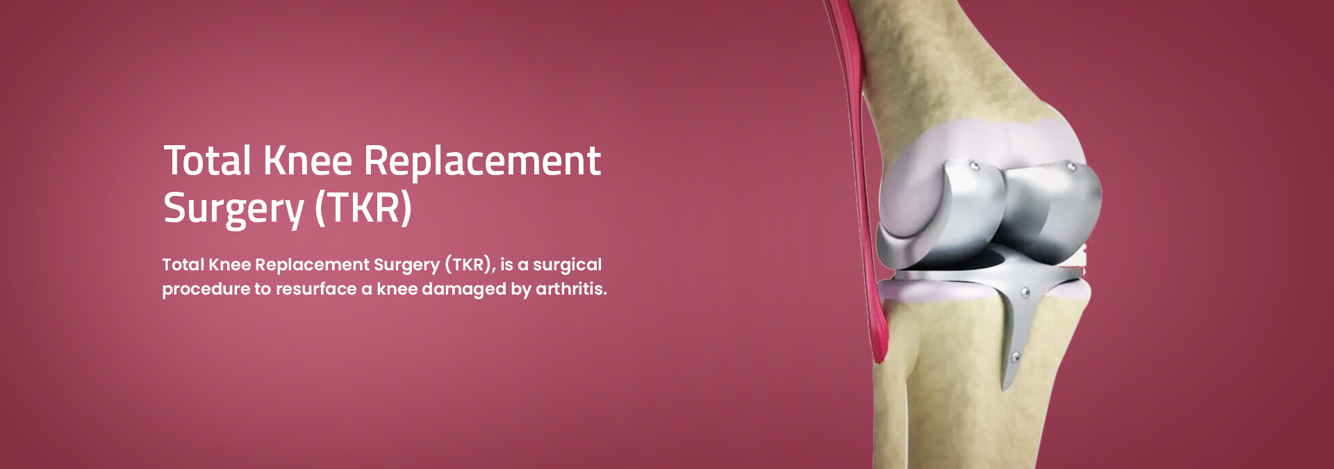 Joint Surgeon in Mumbai